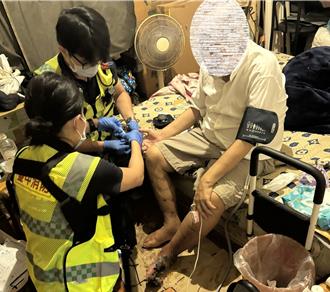 阿北左腳嚴重潰爛堅不就醫 紫到發黑潰爛不堪已壞死