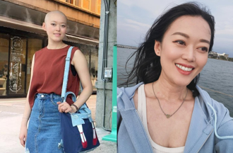 《俗女》女星罹癌又離婚！頭髮掉光化療續命 8年後近況曝光
