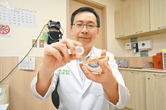 老婦經文看不清就醫 白內障作祟