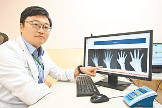 類風濕不痛≠沒事 小心骨侵蝕