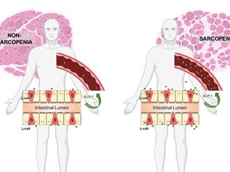 肌少症首見新原因 竟是「腸道荷爾蒙」搞鬼
