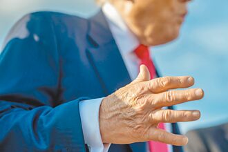 川普罹患慢性靜脈功能不全