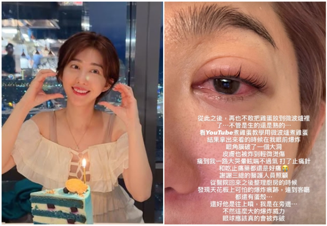 王晴使用微波爐加熱雞蛋，導致爆炸受傷。（圖／翻攝自IG @serena_wang_qing）