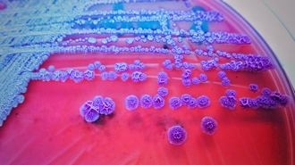 高雄一周爆6例類鼻疽釀2死 累計27例創史上新高