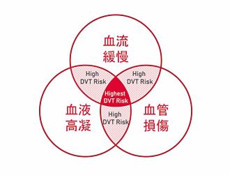 久坐危機 深層靜脈栓塞恐致命