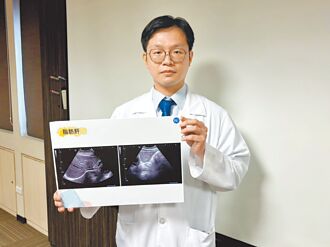 飲酒沒不適 肝病默默找上門