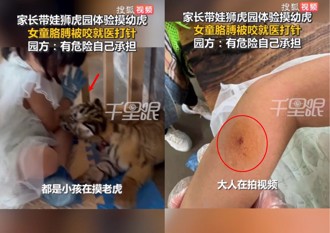 女童體驗摸幼虎遭咬傷　園方：「安全自負」 惹怒家長