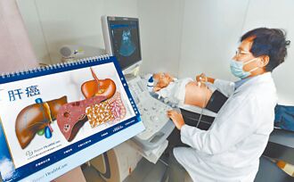 B、C肝炎篩檢下修39歲 8／1上路