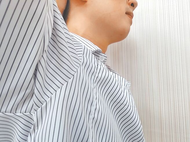 腋臭症俗称「狐臭」，台湾约有10％人口受狐臭困扰，遗传是主要影响因素，若双亲皆有狐臭，子女发生机率高达60％至80％。（王家瑜摄）