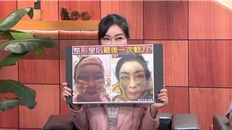 「整容天后」顾婕又动刀了！ 6小时全麻醉：切开整张脸