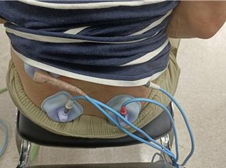 小心腰椎過勞！陶藝家搬重物釀「椎間盤退化」 醫揭危險族群