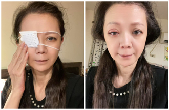 八點檔女星驚傳意外！用傷口藥水點眼睛「一片模糊」」掛急診