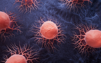 她靠1招抒壓 癌細胞又趁虛而入 醫嘆方法大錯