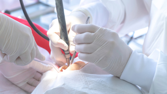 洗牙洗到血流不止 牙医吓坏送急诊 一查竟是血癌