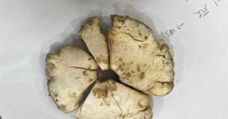 下雨「生菇」别採 专家曝国内毒蕈破60种 1品种最容易被误食
