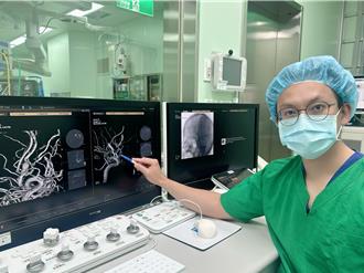 像被雷打到！6旬男劇烈頭痛倒地 腦動脈瘤破裂引發致命疾病