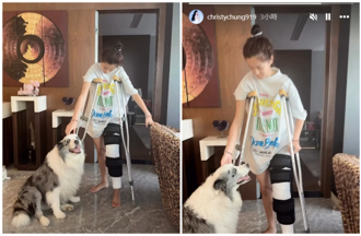 鍾麗緹17歲二女兒排球受傷 「手術後拄拐杖」曝復原進度