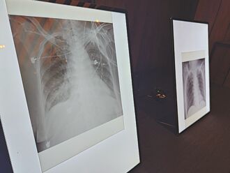 1／3流感家人傳播 老幼要當心