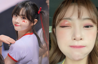 小龙女金娜妍「1天只睡2小时」惨了！美顏长1物恐留永久性伤害