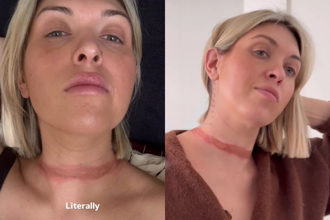 時尚網美圍巾捲車底險遭「斷頭」！脖子勒痕曝光網嚇傻