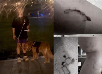 新莊公園黃金獵犬咬傷人　女PO網指控！背後竟藏內幕