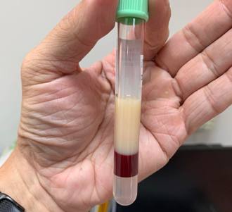 病人「血油油的」连护理师都震惊！她傻眼：手上盐酥鸡都不香了