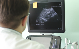 超音波一扫「肿瘤破裂出血」 名医惊觉罹肝癌 3成因累加