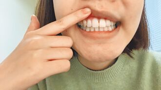 放射治療導致口乾 中醫有解方