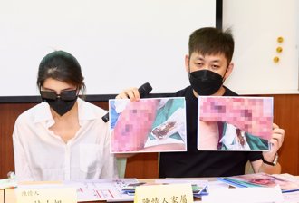 抽脂變洗腎！女做醫美休克、多重器官衰竭 北市衛生局出手了