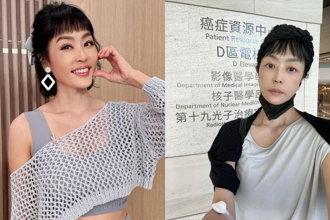 50岁唐玲抗癌成功竟被酸「怎么还活着？」高EQ回击全网讚翻