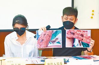 抽脂終身洗腎 立委批醫美亂象