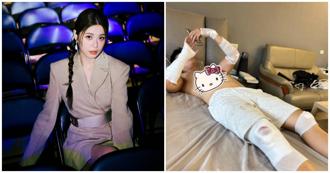 李燕儿自摔！「包成木乃伊」回家　她笑骂：生小孩真的操碎心