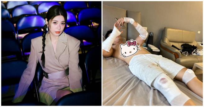 女星李燕昨（5）日在社群透露，孩子因山上過彎碎石多，騎車不慎自摔，當場翻滾了5圈，送往急診室包得跟木乃伊一樣回家。笑罵：「你說生孩子是不是擔心的事太多！」（圖／翻攝FB／李小燕正面思考團）