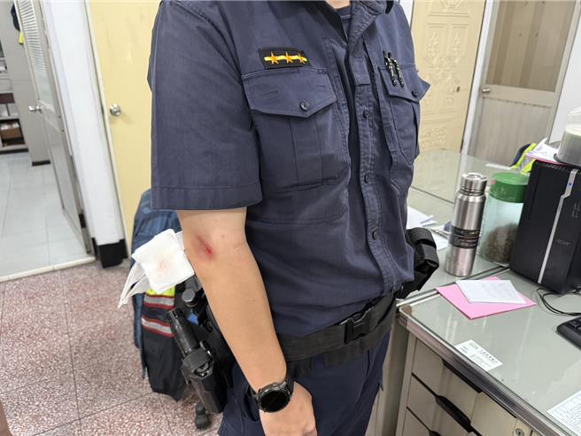 員警被撞倒後，右手臂擦傷。（警方提供／紀爰高雄傳真）