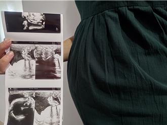 中醫師稱「懷孕不能吃麵食」 涉違食安法將下架影片