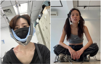 阿諾無預警消失社群 證實「健康亮紅燈」近況曝光