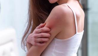 患异位性皮肤炎砸重金试偏方也没用 医吁回归正规治疗