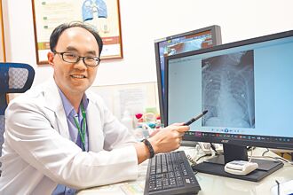 嗜睡咳嗽又胃口差 小心肺炎找上门