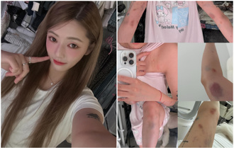 台正妹遭韓男毒打「當地人為何拒報警」？原因細思極恐