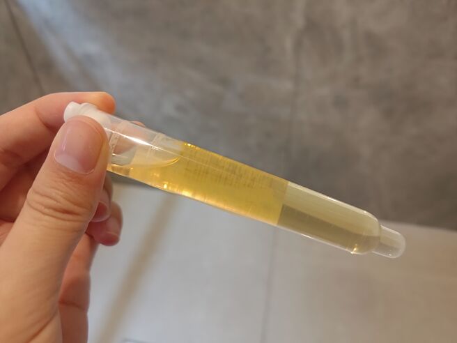 當尿液出現持久的泡沫，就可能是蛋白尿的表現，醫師表示，這個情況不只是腎臟受損的警訊，也和心臟病風險息息相關。圖為尿液示意圖，與事件無關。（報系資料照／王家瑜攝）