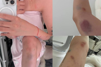 台女被爆打「駐韓代表處終於動起來了」 1原因很愧疚網心疼 