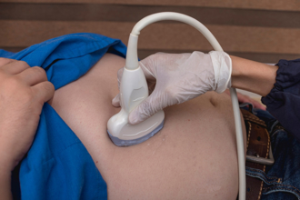 一个月揪出3例肝癌 医喊1检查很重要 有在吃药也要做