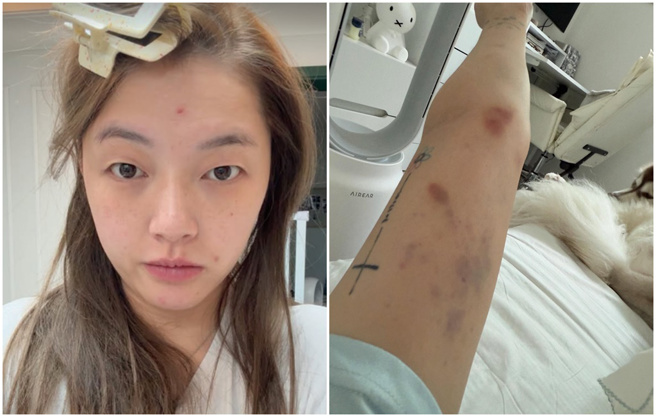 韩媒报导，殴打刘力颖的人是20几岁的陆籍男子。(图/IG@liying0731 )