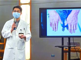 誤當濕疹！男子確診乾癬惡化險毀關節