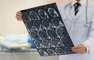 帕金森氏症「第一声警报」手抖前就预警 便秘者小心了