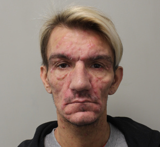 倫敦「掠食性」性侵犯！42歲惡狼隱瞞染HIV 400人恐遭殃