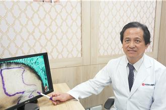 白斑症不再遮掩！黑色素移植讓他額頭膚色全恢復