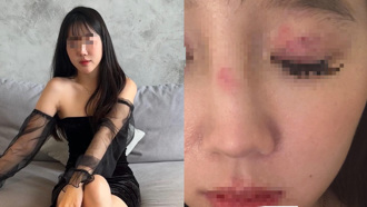 台妹在倫敦遭莫名圍毆  警竟要求「6天後再報案」！外交部出手了