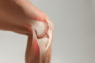 補鈣別一次來 每天分3次才能存骨本 4吃法強化吸收