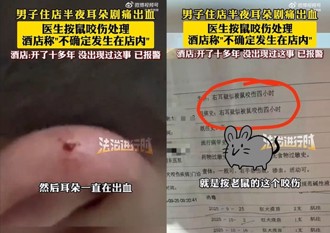 住宿遭鼠咬痛醒血流不止 飯店：沒發生過！已報警